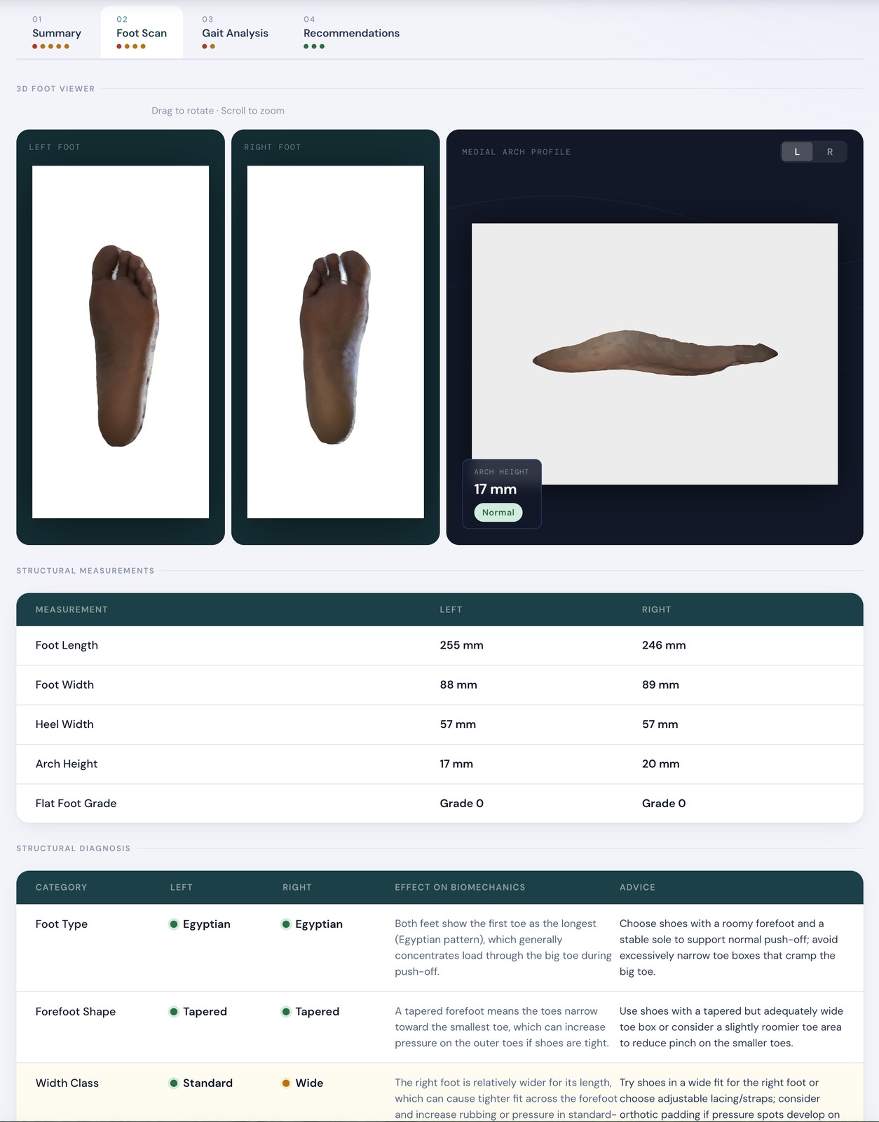 A patient report page showing a 3D foot viewer and structural measurements.